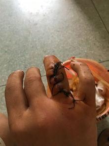 砍伤的伤口能否吃瓜